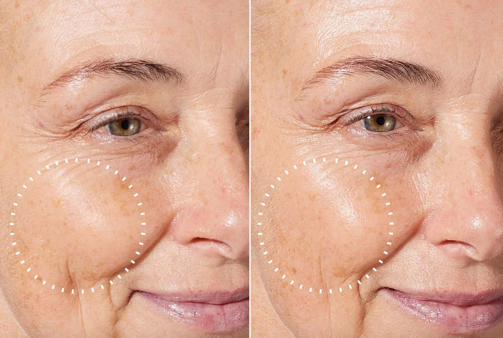 Pilar| 47 años